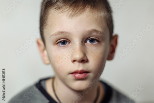 close-up portrait of serious caucasian boy with freckles in casual wear
