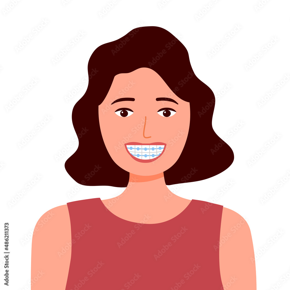Smiling woman with dental braces in flat design on white background. Orthodontic concept vector illustration.