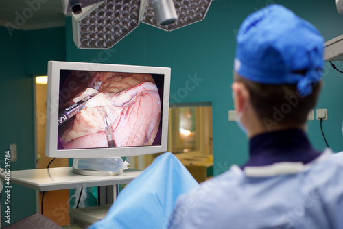 Laparoscopic surgeon looking at monitor during laparoscopic surger photo