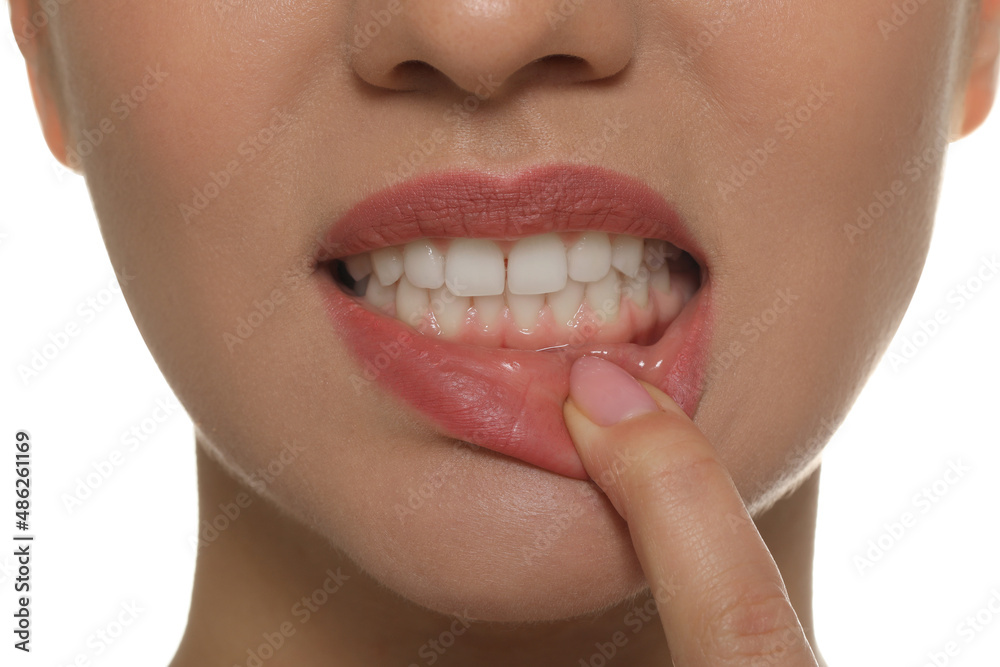 Obraz premium Young woman showing white teeth, closeup view