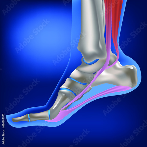 Plantar fasciitis, plantar fasciosis. inflammatory and degenerative changes in plantar fascia. Pain during walking. Vector 3D rendering of the human foot in flexed position