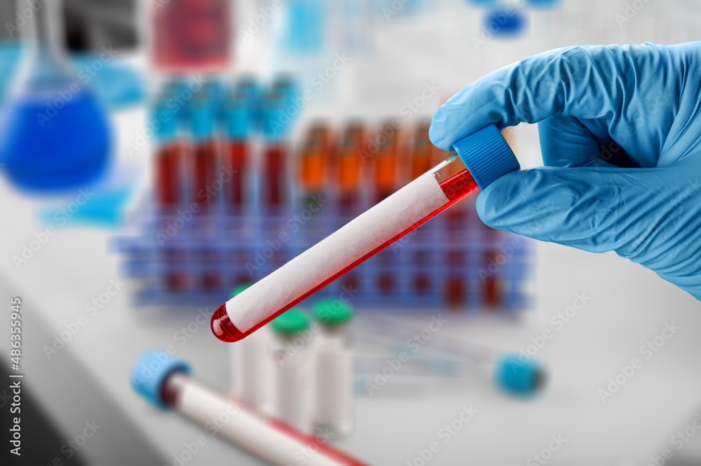Hand of doctor holding a blood test tube during covid-19 outbreak. New strain or varinat coronavirus omicron. Hand of doctor holding a blood test tube during covid-19 outbreak. New strain or varinat coronavirus omicron.
