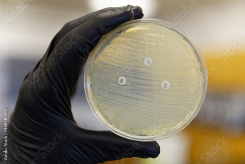 A Pertri plate showing the resistance of bacteria to antibiotics. If the bacteria is resistant the zone of inhibition will not form.