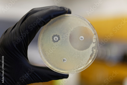 A Pertri plate showing the resistance of bacteria to antibiotics. If the bacteria is resistant the zone of inhibition will not form. photo