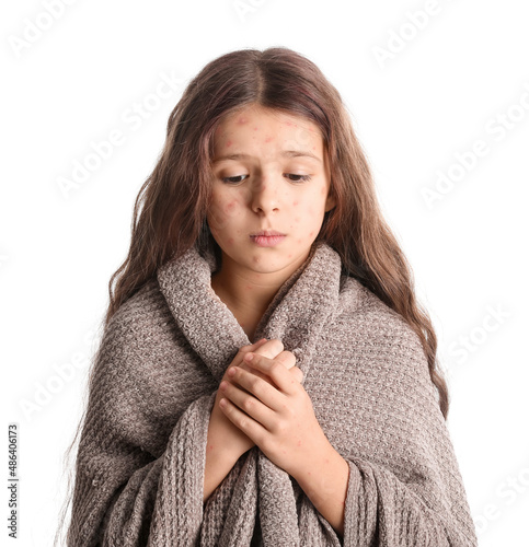 Fotografie Little girl ill with chickenpox isolated on white
