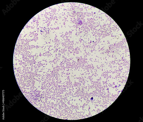 Culture colonies gram stain microscopic shoe staphylococcus aureus bacteria. photo