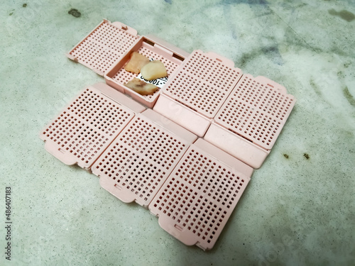 Histology tissue processing embedding cassettes during the specimen process in the biopsy laboratory.