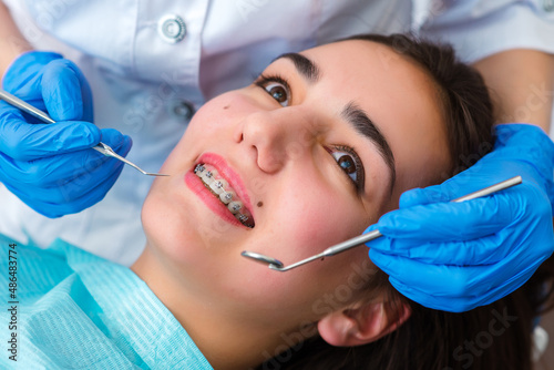 Close up of woman with brackets receiving dental braces treatment in clinic. Orthodontist using dental mirror and forceps while putting orthodontic braces on patient teeth. Concept of dentistry.
