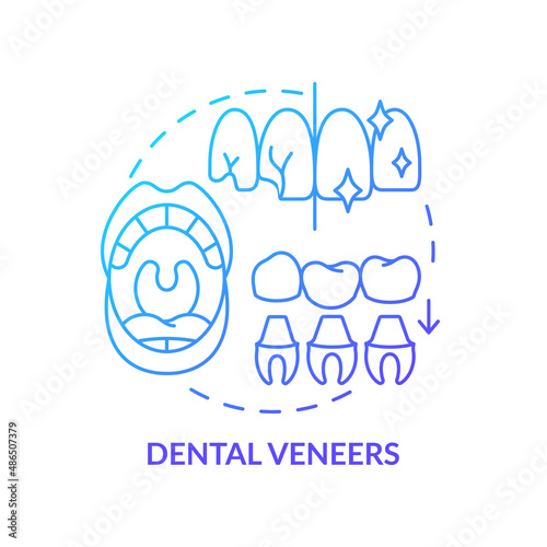 Dental veneers blue gradient concept icon. Aesthetic dentistry type abstract idea thin line illustration. Porcelain veneers installation. Isolated outline drawing. Myriad Pro-Bold font used