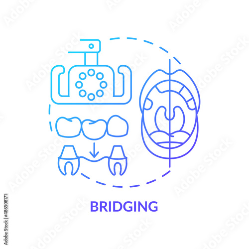 Fototapeta Naklejka Na Ścianę i Meble -  Bridging blue gradient concept icon. Aesthetic dentistry procedure abstract idea thin line illustration. Tooth replacement option. Isolated outline drawing. Myriad Pro-Bold font used