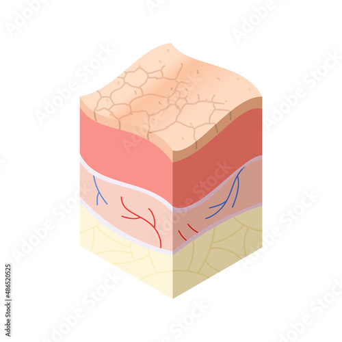 Skincare medical concept. Problems in cross-section of human skin horizontal layers structure. Anatomy illustrative model