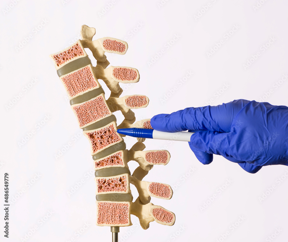 Doctor using hand to demonstrate artificial human spine model in the medical office. The doctor shows with a hand in a glove osteoporosis of the spine. - obrazy, fototapety, plakaty 