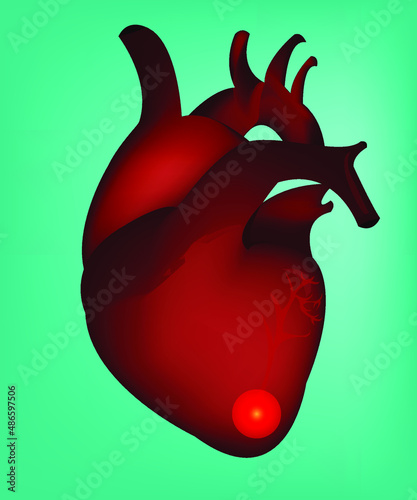 A sick heart. This illustration can be useful for medical and science materials. Vector illustration.