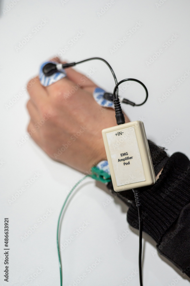 Patient with hand sensors for checking nerve cells brain Patient with hand sensors for checking nerve cells brain