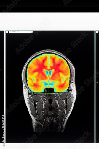 Colorful scan of brain on screen computer photo