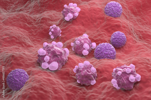 Ovarian cancer cells - isometric view 3d illustration photo