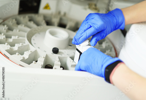 laboratory assistant in blue rubber gloves adds a reagent to the centrifuge of a modern biochemical analyzer.