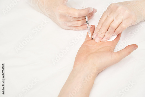 Palm injection at spa salon. Doctor hands in gloves. Closeup. Pretty male patient. Beauty treatment. Healthy skin procedure. Young woman face. Plasmolifting rejuvenation