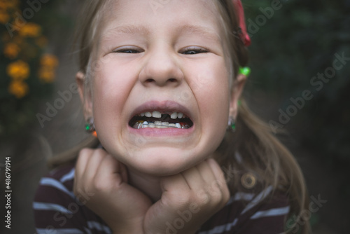 Child with a dental orthodontic device and without one tooth