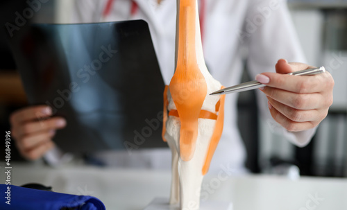 Doctor with xray in his hands showing structure of knee joint on artificial model closeup photo