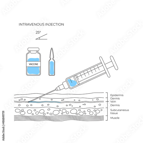 Types of injections. Guide to injecting vaccines into skin. Vector medical procedure manuals for hospital workers