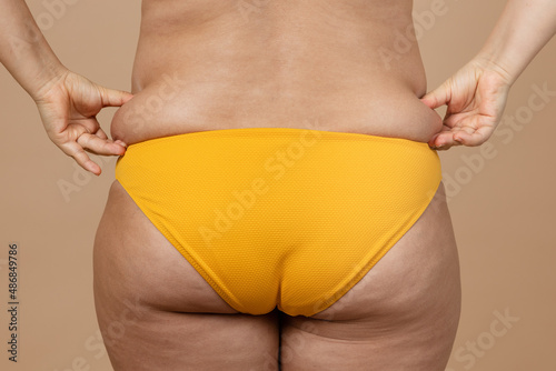 Cropped image of overweight fat naked woman bottom hips, excess fat in yellow underwear. Dangling down, ptosis. Big size. Lifting sagging flabs. Go on diet, sport. Liposuction surgery, cellulite photo