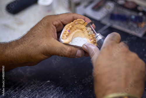 denture making photo