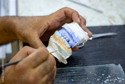 denture making
