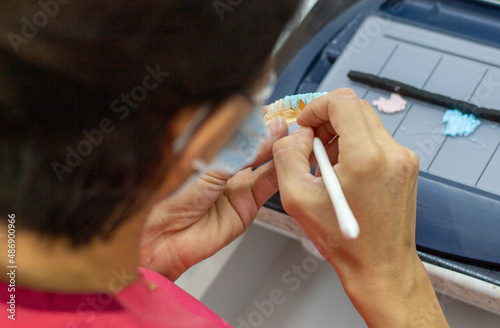 denture making