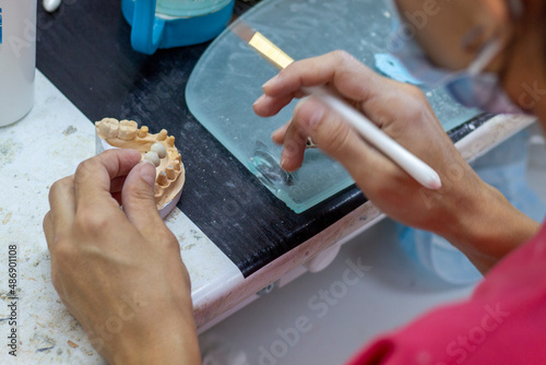 denture making