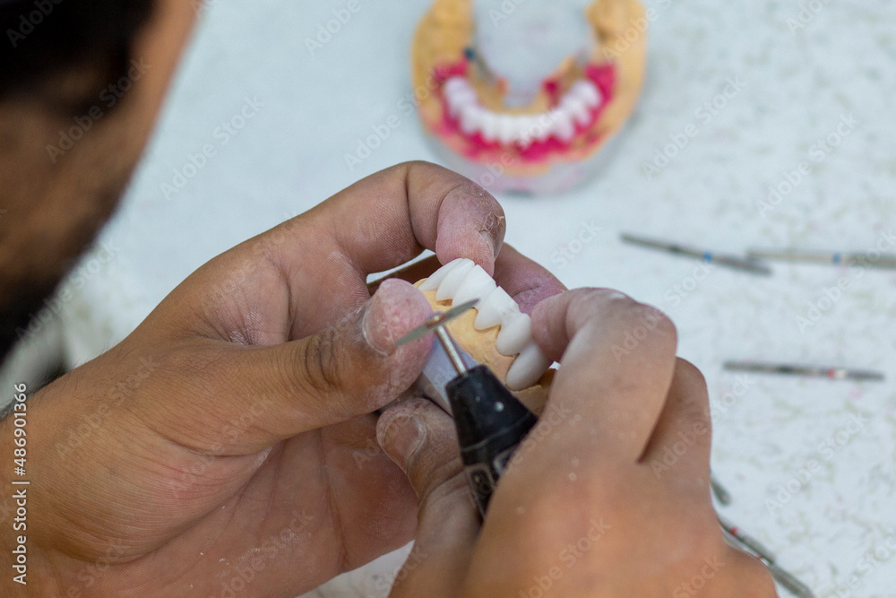 denture making Stock Photo Adobe Stock