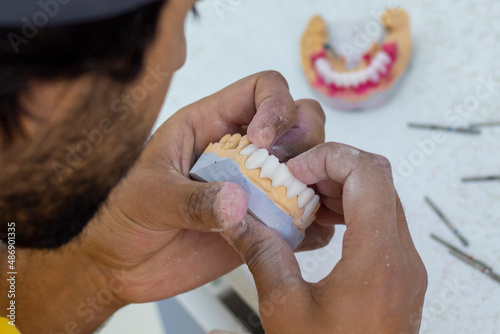 denture making