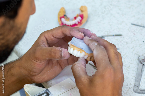 denture making