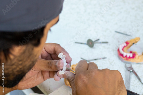denture making