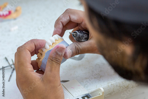 denture making