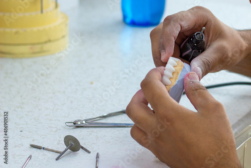 denture making