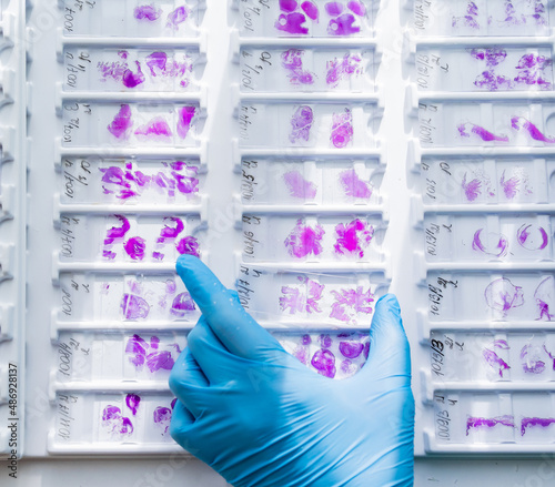 Hand in blue glove holding glass histology slides photo