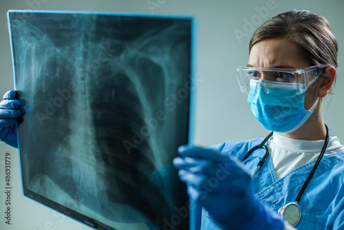 Female GP doctor holding chest x-ray film scan