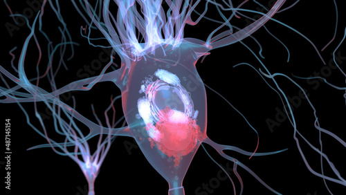 3D Rendering of Lewy Body in Neuron in Parkinson's Disease