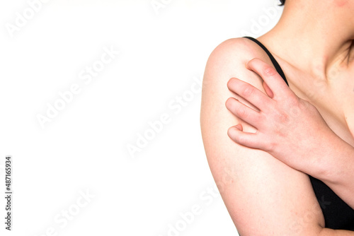 Detalle de una mujer rascando su hombro. Concepto de enfermedades que producen picazón photo