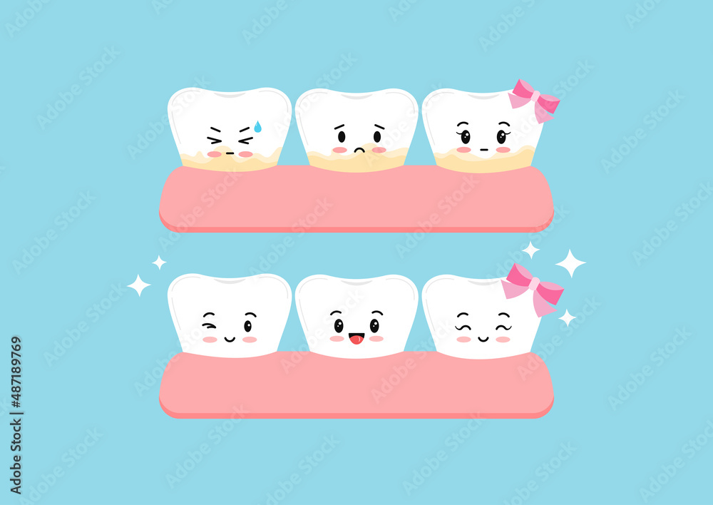 Cute white tooth and with yellow tartar plaque before after kids icon set. Teeth in gum kawaii character stain treatment, remove and cleaning concept. Flat cartoon vector illustration. 