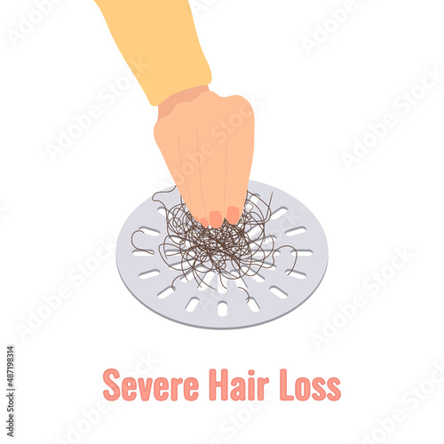 Hand removing hair clump from the shower drain. Hair fall problem and alopecia diagnostics concept. Cleaning grid after washing scalp. Cartoon vector illustration