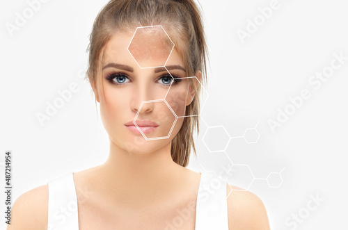 Dark spots, freckles,hyperpigmentation(melasma or chloasma),concept - skin lightening, skin whitening, fruit acids,AHA, Skin Brightening photo