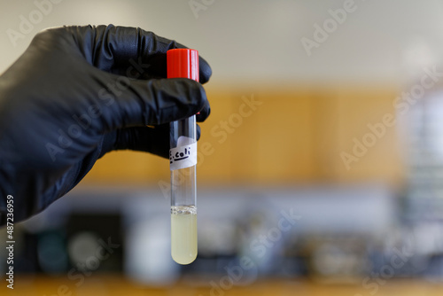 E. coli culture in a test tube. This organism lives in the intestinal tract of warm-blooded animals. photo