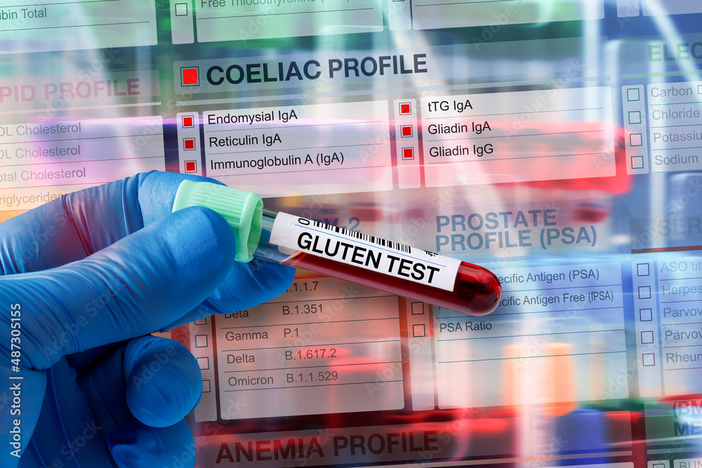 Blood Tube Test With Requisition Form For Coeliac Test Blood Sample blood-tube-test-with-requisition-form-for-coeliac-test-blood-sample