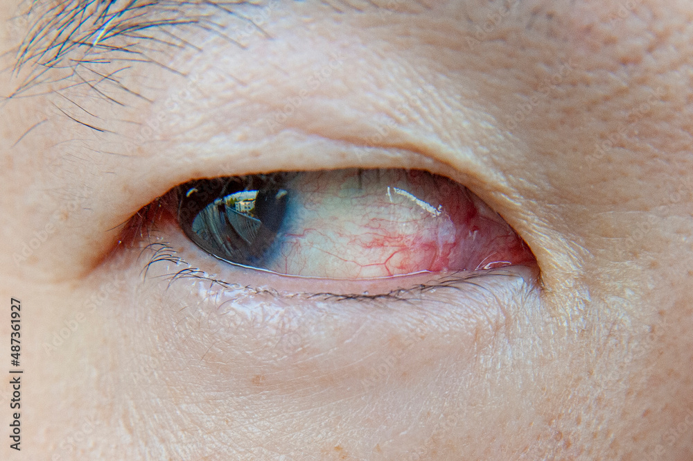Obraz premium Close-up Asian man eye with eye irritation