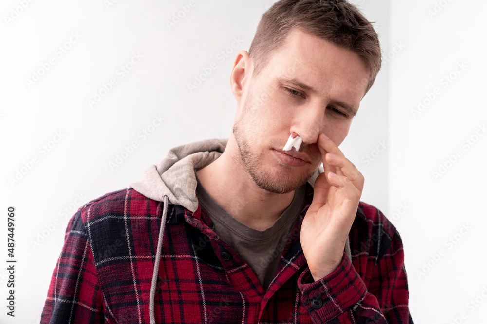 young man has broken nose with blood going out it and stop it with a napkin, unfortinate accident young man has broken nose with blood going out it and stop it with a napkin, unfortinate accident