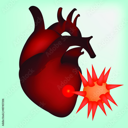 A heart with pain and a virus. This illustration can be used as a medical concept. Vector illustration.