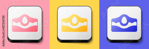 Isometric Acne icon isolated on pink, yellow and blue background. Inflamed pimple on the skin. The sebum in the clogged pore promotes the growth of a bacteria. Square button. Vector