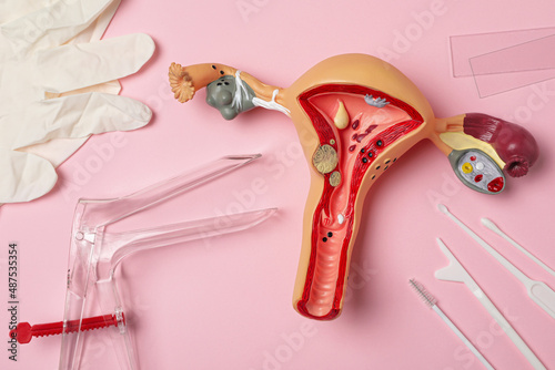 Gynecological examination kit and anatomical uterus model on pink background, flat lay photo